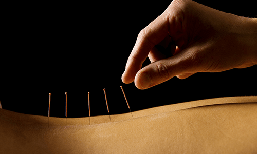 acupuncture-male.impotence.therapy.method